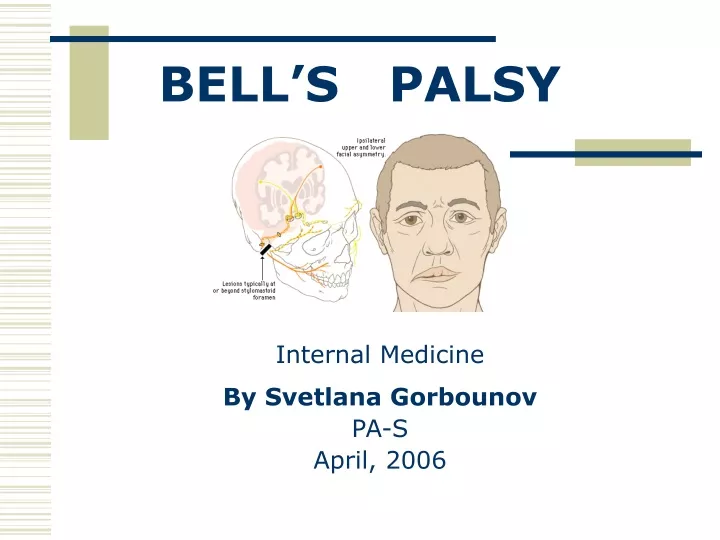 bell s palsy