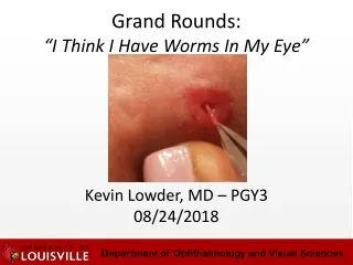 Grand Rounds: “I Think I Have Worms In My Eye”