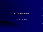 Nasal fractures