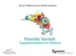 Fluoride Varnish