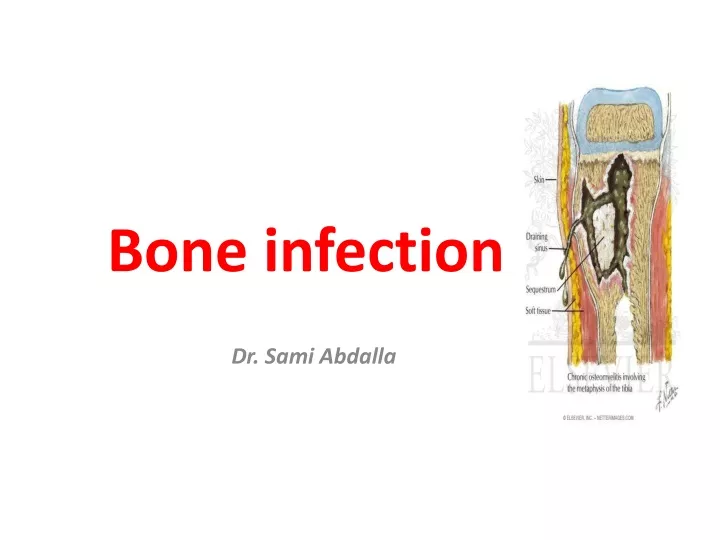 bone infection