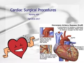 Cardiac Surgical Procedures