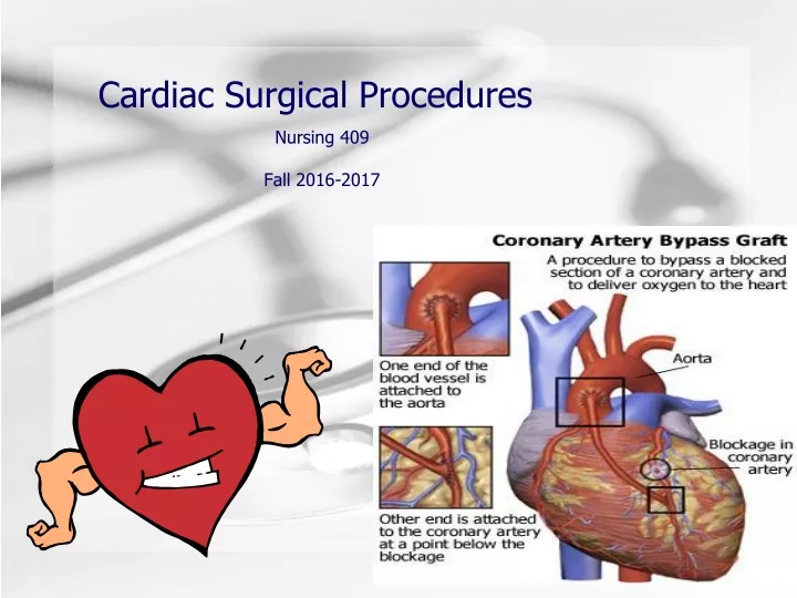 cardiac surgical procedures