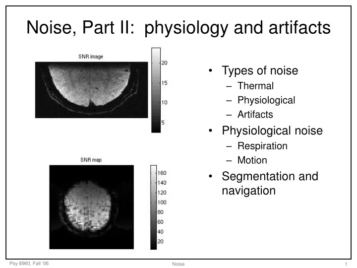 noise part ii physiology and artifacts