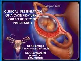 CLINICAL  PRESENTATION  OF A CASE PID~TURNED OUT TO BE ECTOPIC PREGNANCY