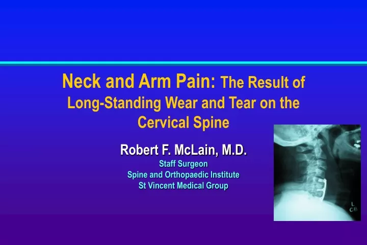 neck and arm pain the result of long standing