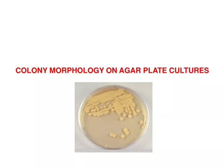 colony morphology on agar plate cultures