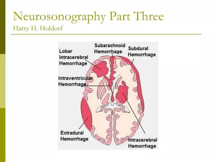 neurosonography part three harry h holdorf