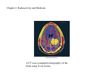 Chapter 4  Radioactivity and Medicine