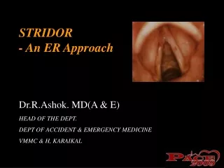 STRIDOR - An ER Approach