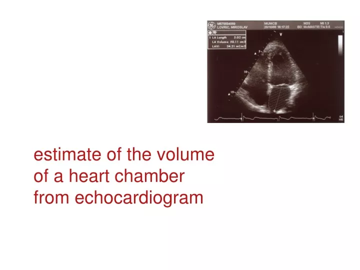 estimate of the volume of a heart chamber from