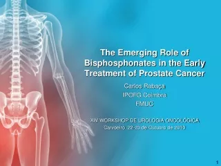 The Emerging Role of  Bisphosphonates  in the Early Treatment of Prostate Cancer