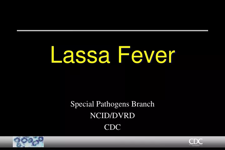 lassa fever
