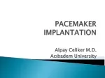 PACEMAKER IMPLANTATION - slide 1