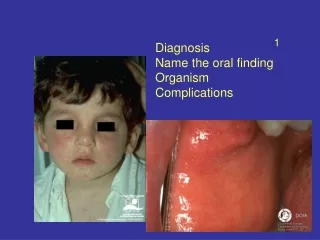 Diagnosis Name the oral finding Organism Complications