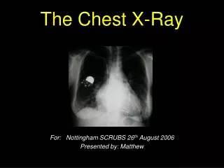 The Chest X-Ray