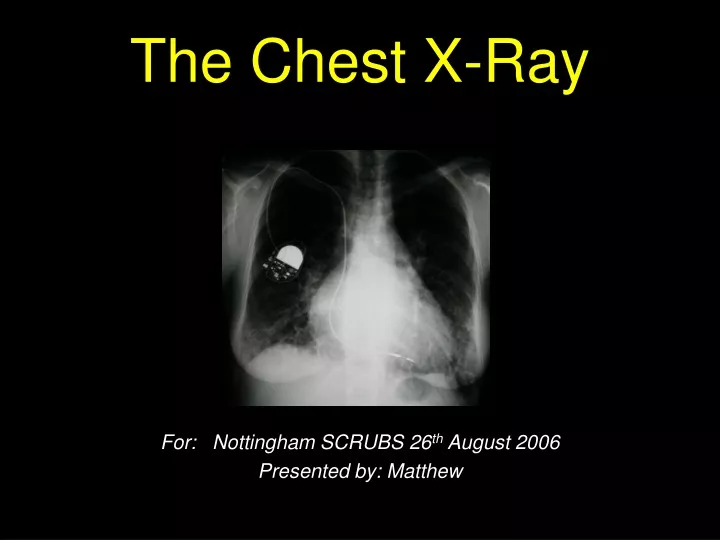 the chest x ray