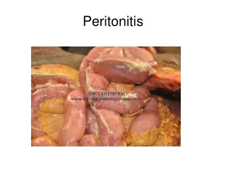 Peritonitis