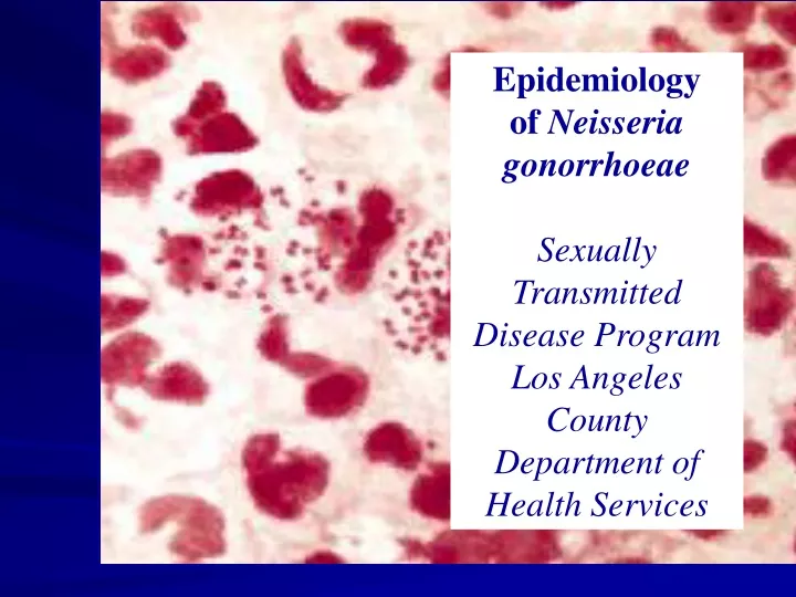 epidemiology of neisseria gonorrhoeae sexually