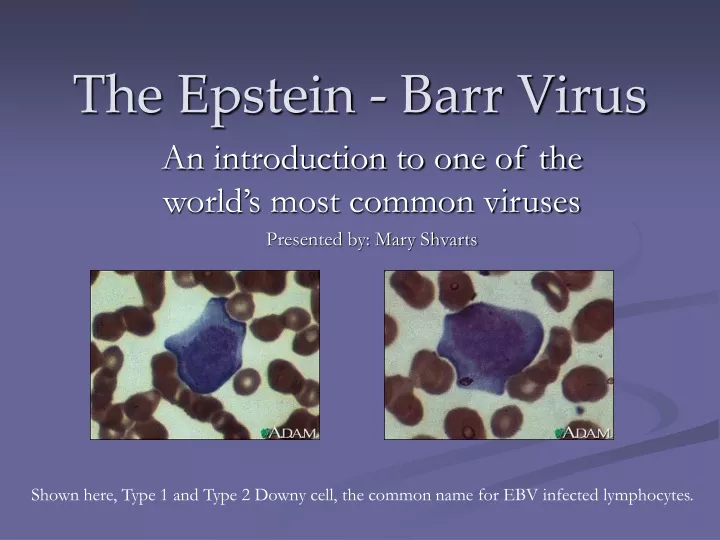 the epstein barr virus