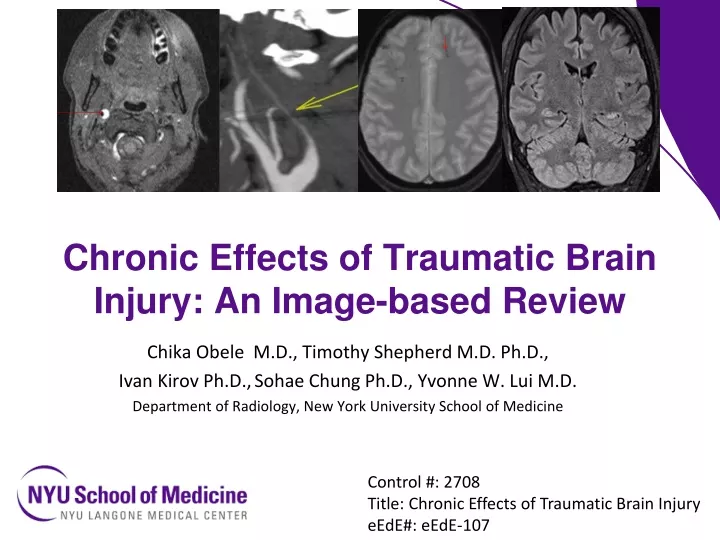 chronic effects of traumatic brain injury an image based review