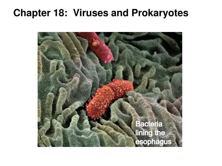 chapter 18 viruses and prokaryotes