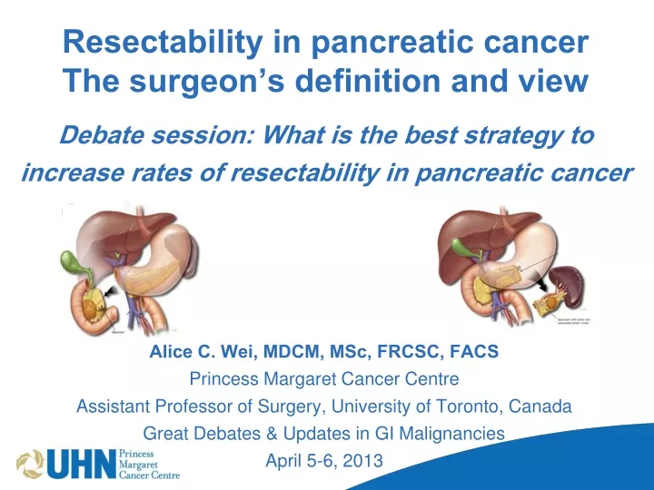 resectability in pancreatic cancer the surgeon