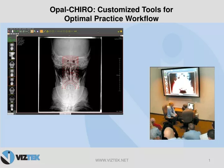 opal chiro customized tools for optimal practice