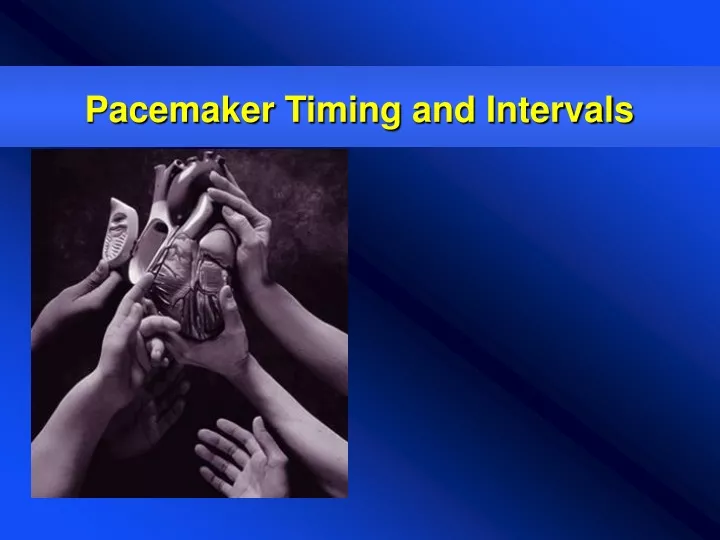 pacemaker timing and intervals