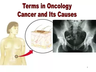 Terms in Oncology &amp; Its Causes