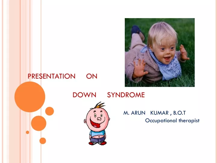 presentation on down syndrome m arun kumar
