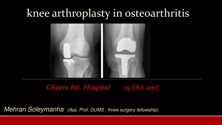 knee arthroplasty in osteoarthritis