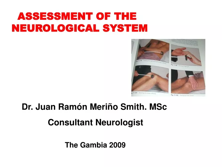 assessment of the neurological system