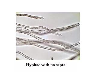 Hyphae with no septa