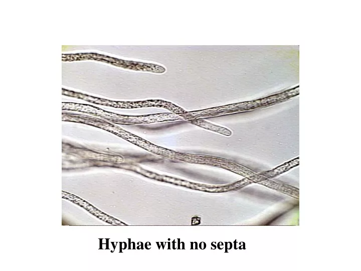hyphae with no septa