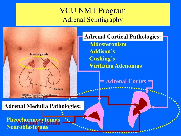 vcu nmt program adrenal scintigraphy
