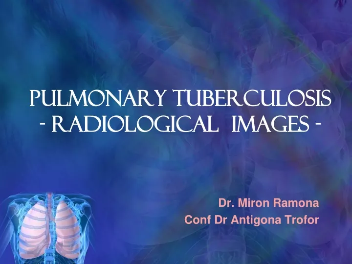 pulmonary tuberculosis radiological images