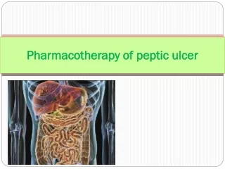 Pharmacotherapy of peptic ulcer