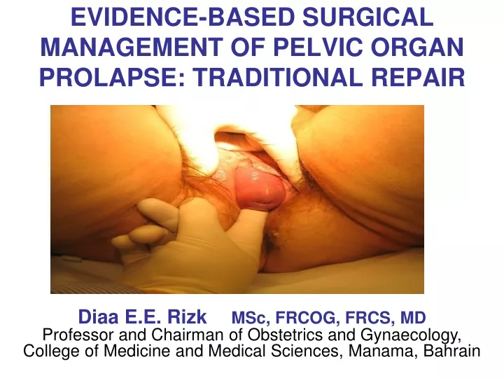 evidence based surgical management of pelvic organ prolapse traditional repair