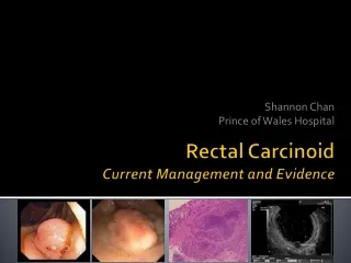 Rectal Carcinoid Current Management and Evidence