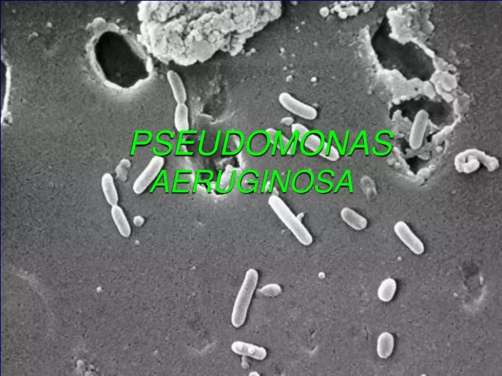 pseudomonas aeruginosa