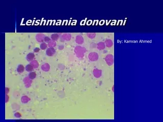 Leishmania donovani