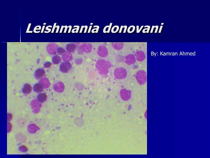 leishmania donovani