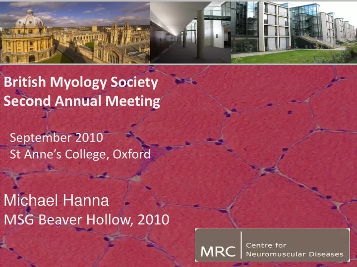 british myology society second annual meeting