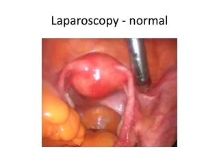 Laparoscopy - normal