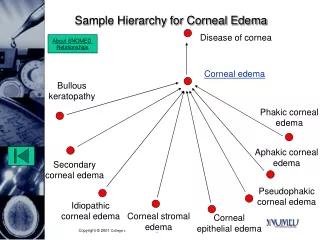 Sample Hierarchy for Corneal Edema
