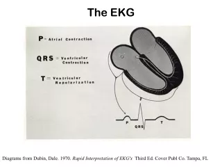 The EKG