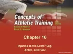 Foot Anatomy and Injuries: A Comprehensive Guide - slide 1