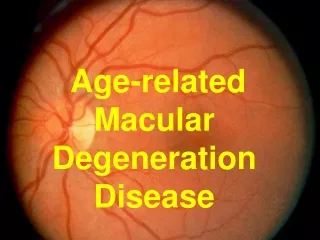 Age-related  Macular Degeneration Disease