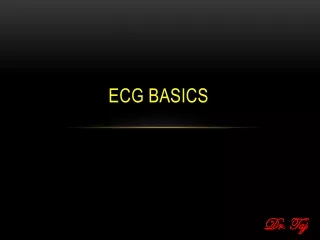ECG Basics